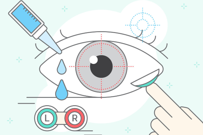 白內(nèi)障治療