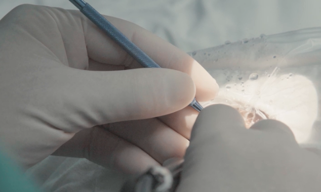 白內(nèi)障手術